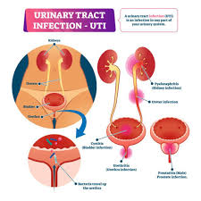 how do you get a uti